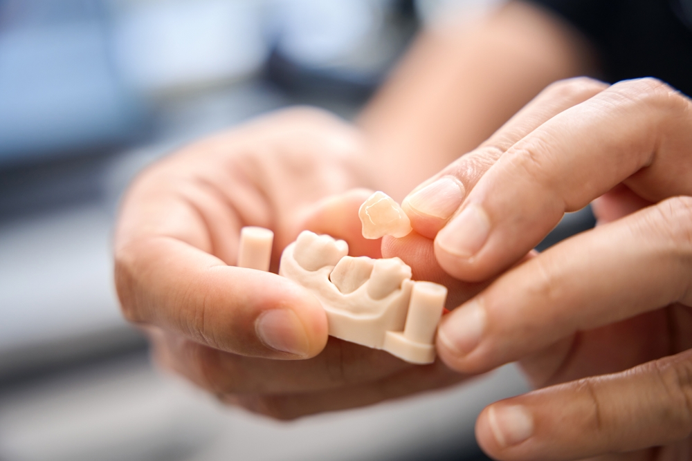 Dental Crowns in Allen